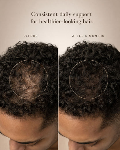 Volyrian – Advanced Hair Complex