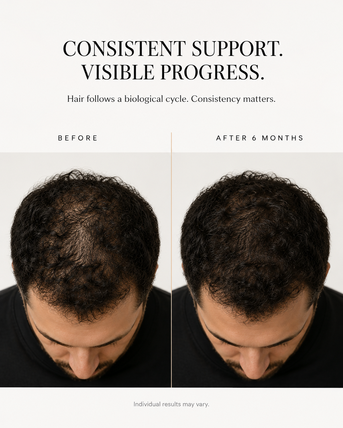 Volyrian – Advanced Hair Complex